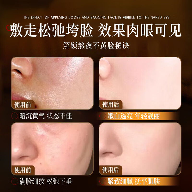 SEEDONVEUR Astragalus anti-wrinkle mask 10 pieces anti-wrinkle firming and staying up late first aid moisturizing dark yellow brightening gold list women and men