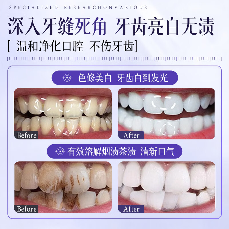 Beishi Whitening Stain Remover Toothpaste Removes Smoke Stains, Removes Yellow Bad Breath, Brightens Whitening Removes Tartar and Protects Gum Toothpaste Gold List No. 1 100g