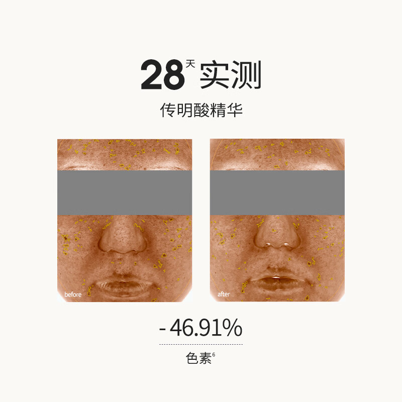 SOUNDER ONE Three Egg Pills 5% Tranexamic Acid Clarifying and Rejuvenating Moisturizing Essence 30ml Tranexamic Acid New Year Gift for the Year of the Horse