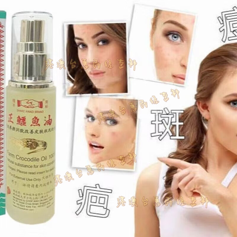 Shake Hand Brand Shake Hand Brand Alligator Oil Imported from Singapore Crocodile Oil Hua'an Pharmacy Fine Lines, Acne and Scar Repair 46ML-Large Bottle Singapore Alligator Oil Shake Hand Brand