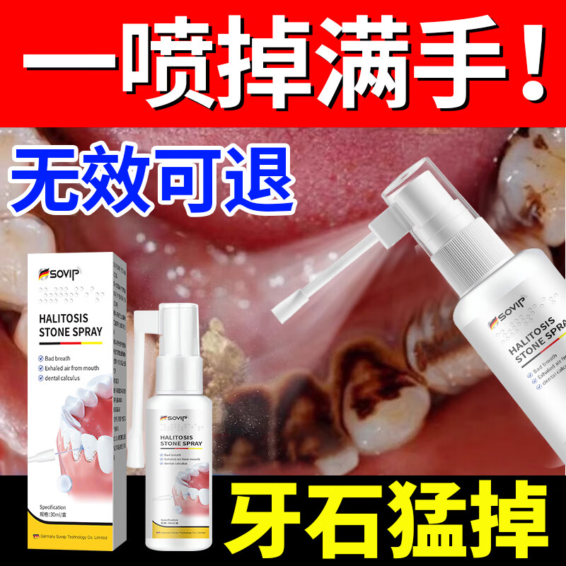 SOVIP German dental calculus cleaning artifact, antibacterial, remove bad breath, remove dental calculus, remove yellow, remove tobacco stains, remove tartar, non-mouthwash