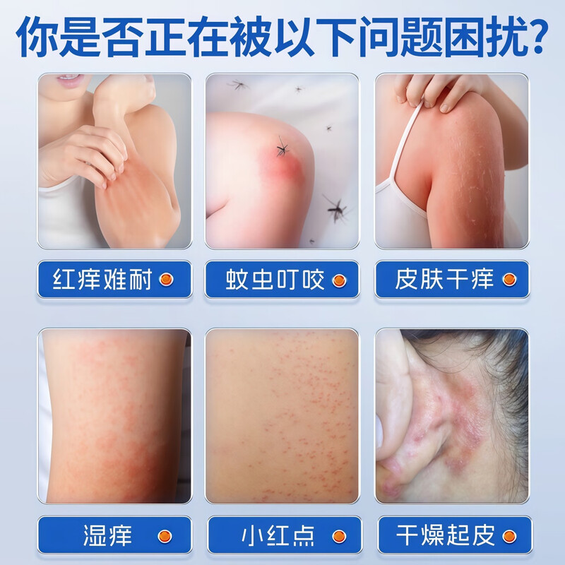 Pity cream calamine soap for bathing, prickly heat and wetness to relieve itching, dry skin, itchy body, itchy skin soap for the elderly and children