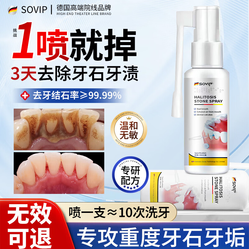 SOVIP German dental calculus cleaning artifact, antibacterial, remove bad breath, remove dental calculus, remove yellow, remove tobacco stains, remove tartar, non-mouthwash