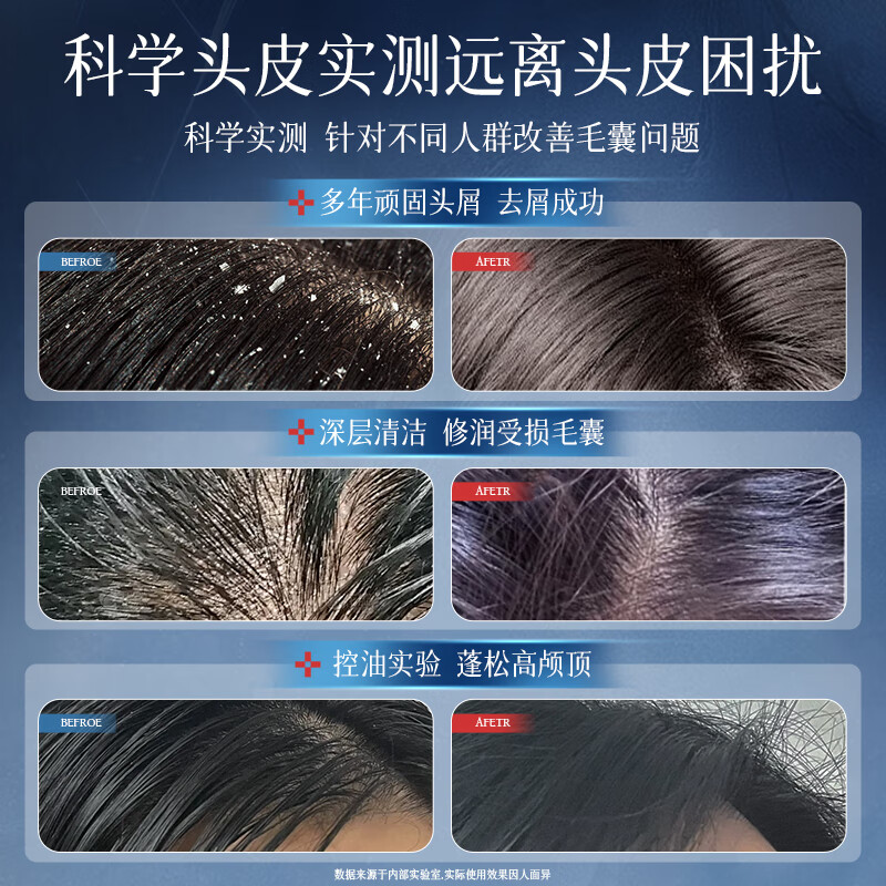 SEEDONVEUR BL men's shampoo and shower gel set cologne oil control anti-dandruff anti-itch hydrating college students 2 bottles