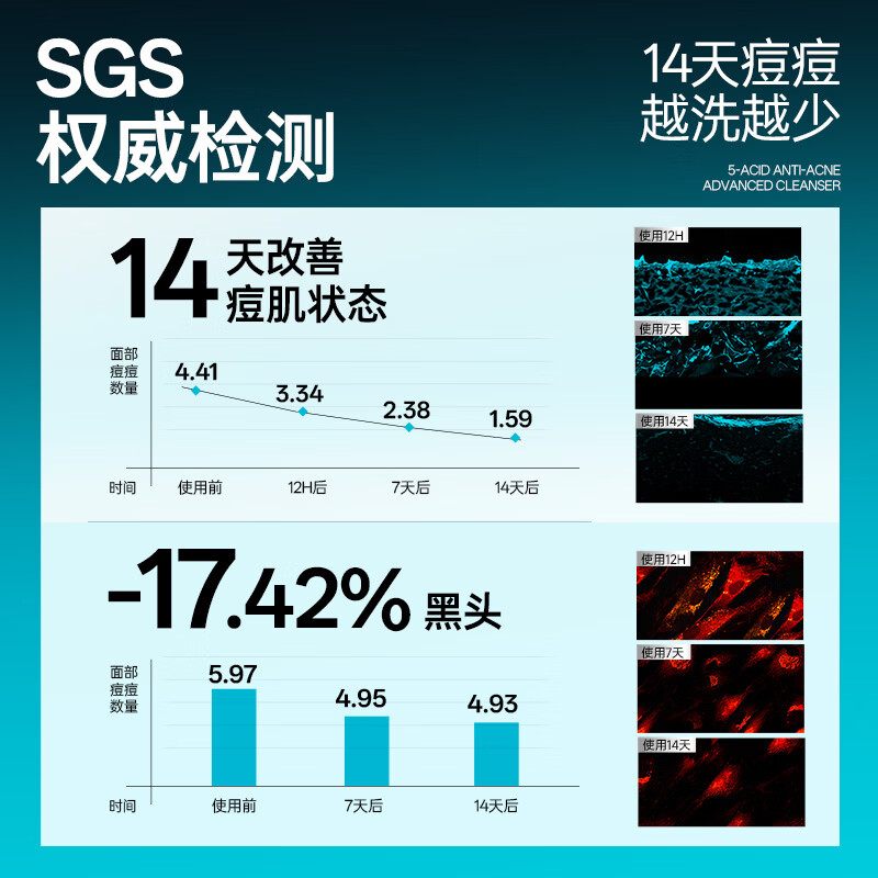 Left color and right color Zheng Kai endorses men's slightly acidic facial cleanser, anti-acne cleanser, oil control, blackhead removal, skin care products, New Year's gift