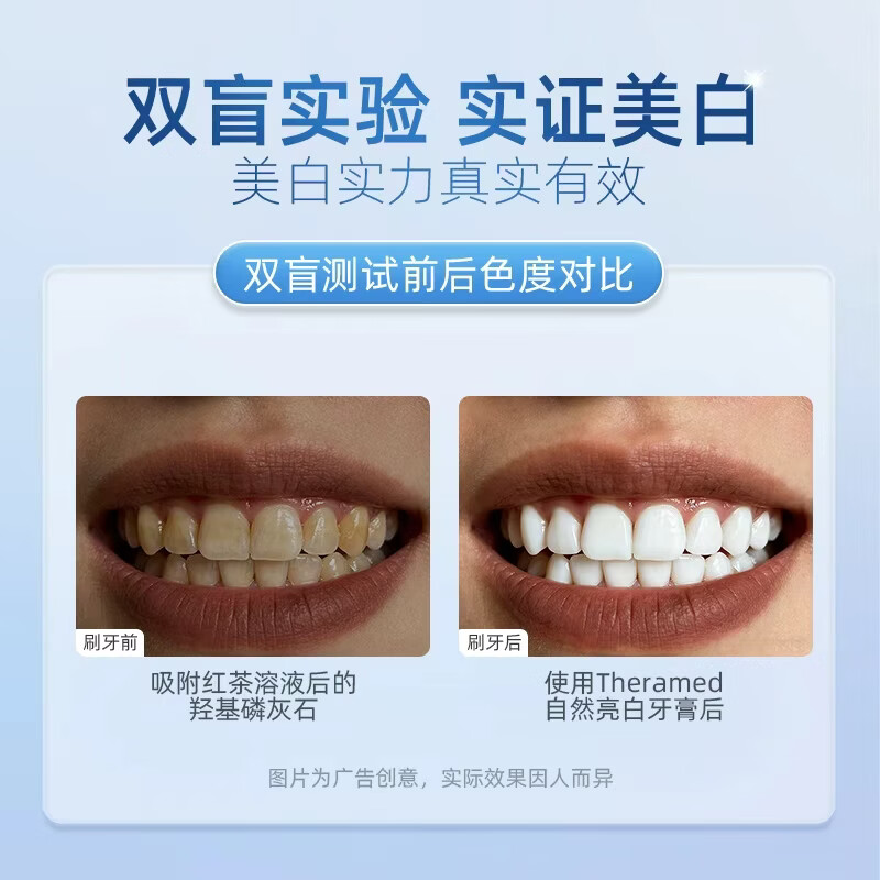 Tooth Guard (THERAMED) Germany imported Henkel whitening and brightening toothpaste to remove stains, remove tobacco stains, prevent tooth decay, strengthen teeth, fresh breath