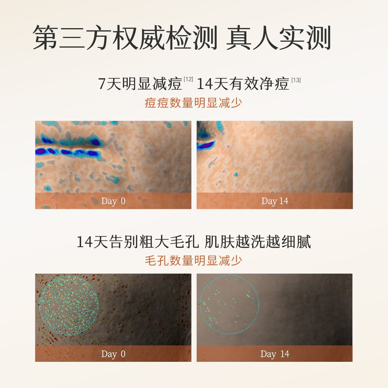 Half an Acre Flower Field Calendula Cleansing Mousse Amino Acid Facial Cleanser for Men and Women, Oil Control, Acne Removal, Deep Cleansing and Moisturizing 550g