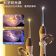 COOKSS children's ear picking luminous ear picking artifact rechargeable ear tweezers newborn visible high-definition ear picking 3-piece set