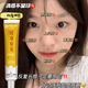 Acne removal cream removes acne for men and women students, closes the mouth of acne, fades acne scars and pits, 3888 times the effect [for acne scars and acne skin]