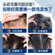 RUYI mite-removing and itching shampoo 500g Mao Yanning silicone-free oil control anti-dandruff seborrheic hair follicle scalp cleaning