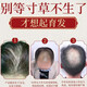 南京同仁堂生姜洗发水防脱育发洗发水脱发固发控油草本老姜王400ml*1+泵头*1