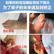 Baby and Children's Big Foot Toe Valgus et Backle Toe Correction Dispositif pour les enfants Toe à orteil curvé Splitter Yunan Yunfang Pharmacie Pharmacie (826) 1 à 8 ans White Five-Finger Toe Splitter / Deux paires les deux tailles