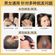 南京同仁堂防脱育发洗发水生姜洗发露头发增长密固发增长脂溢性脱发严重男女 一瓶装400ml【医师认证】