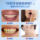 SMILEKIT 炫白牙贴牙齿贴片温和亮白美去牙黄牙烟渍黑牙口气清新14对28贴