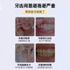 Nanjing Tongrentang Helicobacter Pylori Zahnpasta Gingival Atrophy Zähne lose Tartare, um schlechte Atemzähne gelbes Zahnabscheider eine Schachtel [orale Antibakterien- und Gingivalschutz Frischem Atempasta] 120 g/Pin