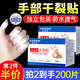 KOOGIS hand Vaseline dry crack patch, cracked finger patch, cracked crack protection non-medical genuine anti-crack tape