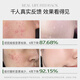 Andwarm Japan imported acne scars, azelaic acid salicylic acid acne removal cream acne removal essence acne pit repair redness and swelling acne men and women [Acne removal mites] acne removal cream + mite removal facial cleanser