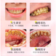SMILEKIT日本美白牙贴去黄牙去牙渍烟渍牙贴美白牙齿去牙黄炫白变白牙贴片 1盒装【14片=7对】