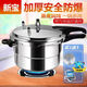 XINBAO explosion-proof pressure cooker household gas small induction cooker universal pressure cooker thickened commercial large capacity mini 2 people gas open flame special 20cm (4 liters) 2-3 people