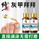 Correct onychomycosis antibacterial liquid, non-special effect, deck thickening and discoloration, nail groove fungal infection, impatiens sterilization and nail removal, 1 bottle of onychomycosis antibacterial liquid, mildly applicable