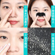 Mengxilan blackhead removal and nose patch absorb acne-sucking and mouth-cleaning cleaning of pig nose membrane hole sheath set nose patch for men and women 2 boxes + [2 bottles of freeze-dried powder essence water]
