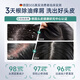 沃森博士去屑止痒二硫化硒毛囊洗发水控油蓬松毛囊洗剂头膏露男女500ml