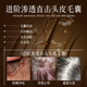 HIEUAILR德国进口原料洗发水男女专用除螨祛痘去屑止痒控油持久蓬松洗发露 【控油除螨祛痘】808ml*1