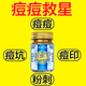香港大药房香港大房痘膏痘印痘坑修复淡化痘印痘疤痘痘HXM9737 [香港痘膏]3 [香港祛痘膏]5盒-尊享祛痘装-