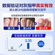 Dr. Xin's onychomycosis special effect specializes in treating nail infection with yellowing and thickening root cream 30ml.
