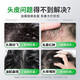 匠心丝华 JXSH胖东来二硫化硒洗发水洗剂1%毛囊清洁洗发水炎去屑止痒控油洗发露 【一瓶400ml】深度去屑止痒