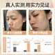 Qingyan sulfur facial cleanser oil control moisturizing and mites removal and blackhead removal for men and women universal facial cleanser face wash soap 2 packs