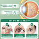 
FIT MOMENT Lutein Eye Protection Spray Cleansing Eye Relieves Dry Eye Care Eye Care Eye Cleansing Eye Cleansing Eye Moisturizing Spray