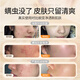 Qingyan sulfur facial cleanser oil control moisturizing and mites removal and blackhead removal for men and women universal facial cleanser face wash soap 2 packs