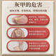 Guangyao Baiyunshan onychomycosis 100% special effect medicine No. 1 nail fungus infection removal onychomycosis root I treatment imported severe special effects in a box
