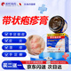 Songding Pharmaceutical Herpes Zoster Ointment Sequelae Neuralgia Root-cutting Snake Discoil Skin Rash Dermatitis Eczema Itching Special Non-drug