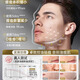 
Korean Grain Salicylic Acid Mask for Men's Oil Control and Acne Marks Removal of Acne Marks Blackhead Shrinking Pores Whitening Hydrating Moisturizing Soothing Repair