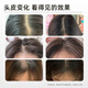 伊千语【伊千语洗发水】防脱控油尹千语洗发膏侧柏叶改善掉发防断发 【洗护装】洗发水+香氛发膜