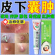 Mupirocin ointment, sebaceous cyst ointment, can be used to see the face, remove subcutaneous acne, powdery tumor hyperplasia, redness, inflammation, boils, poisonous pimples, pustules, anti-inflammation, treat pustules, poisonous boils, 2 boxes of red pimples and swelling on the body