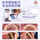 沃朗森医用含氟牙膏状成人防蛀脱敏蛀牙洞修复龋齿护龈固齿抗牙疼去口臭