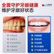 Hisaoka Pharmaceutical Medical Periodontitis Gingivitis Special Toothpaste for Bleeding and Swelling Pain 120g Hisaoka Pharmaceutical Medical Periodontitis Gingivitis Special Toothpaste for Bleeding and Swelling Pain 120g