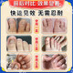 Akita Zeren's special medicine for onychomycosis, special nail fungus infection removal, bad nail brightening, root treatment, original imported from Japan, special effect, today's special offer, shoot 1 for 3, JD.com, what medicine is good for onychomycosis, fast, special ointment for onychomycosis room