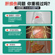 Yangzhisu Yunnan Baiyao Liver Huantian Tablet Yangzhisu Sushu Gan Tablets Liuxuan Liver Health Liver Social Drinking Stay up late to detoxify and reduce aminotransferase 3 bottles of powerful packaging [Consolidation and strengthening, say goodbye to liver problems]