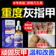 Dr. Xin's onychomycosis special effect specializes in treating nail infection with yellowing and thickening root cream 30ml.