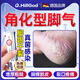 Dr.HillGod's athlete's foot, itching, peeling, rotten feet, fungal infection, itchy, sweaty feet, special medicine for cracked feet, dry and cracked heels, two boxes with special effects
