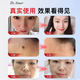 DR.NEUER Spot Mole Removal Cream, Wart and Black Mole Removal, No Scars and No Pain Marks on the Face, Special Wart Spotting Potion, Special for Children.