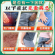 Luo Shenyi anal itching ointment to relieve itching, special perianal eczema moist root removal, sterilization, butt itching, hemorrhoids, itching, fungal infection, 1 box, special anti-itching cream