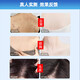 Gukanlin arm folliculitis red blood acne improves skin and scalp red rash pustules Get 2 boxes with discount