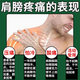 Xiangyu Lekang Naproxen Tablets 0.1g*50 tablets 5 boxes of frozen shoulder medicine, oral medicine for shoulder pain, special medicine for shoulder circumference strain, inability to lift the arm, stiffness, difficulty in lifting the arm, shoulder pain analgesic, long-term recurring frozen shoulder