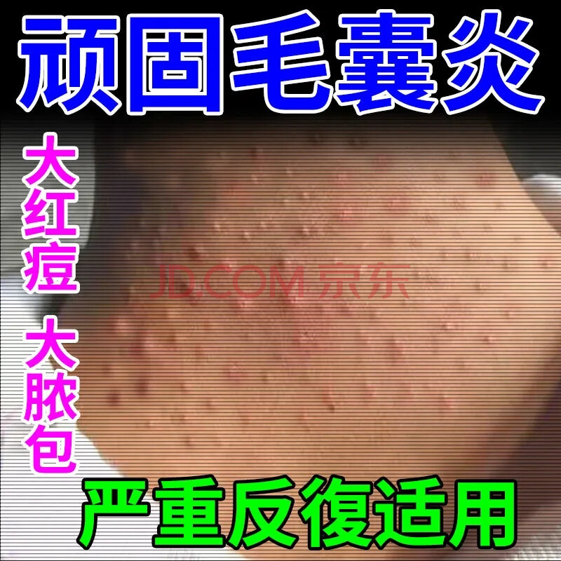 头起鸡皮疙瘩的感觉(莫名其妙的感觉头皮鸡皮疙瘩)