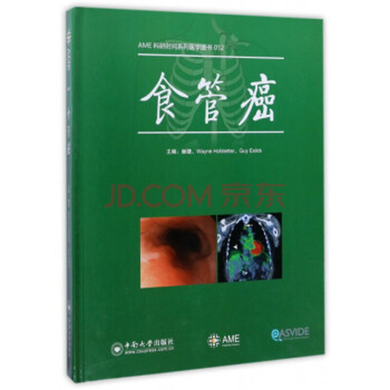 《 食管癌 》【摘要 书评 试读】- 京东图书